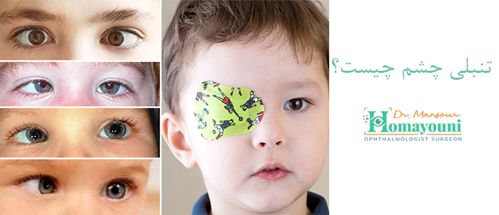 تنبلی چشم چیست؟