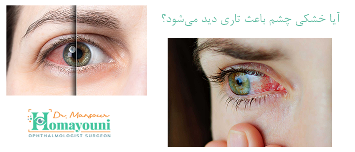 خشکی چشم و تاری دید