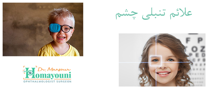 علائم تنبلی چشم