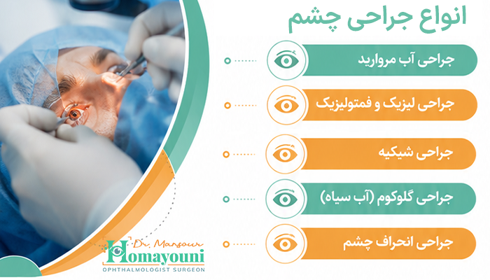 انواع جراحی چشم