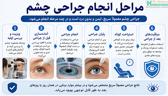 مراحل انجام جراحی چشم
