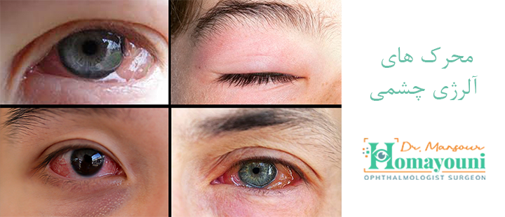 محرک های آلرژی چشمی