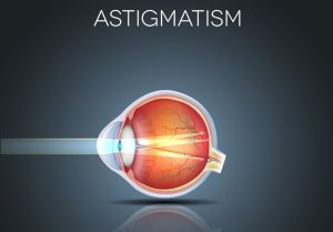 آستیگماتیسم چشم