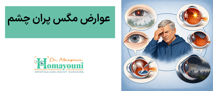 عوارض مگس پران چشم