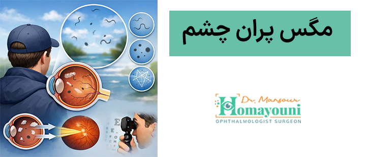 مگس پران چشم چیست؟