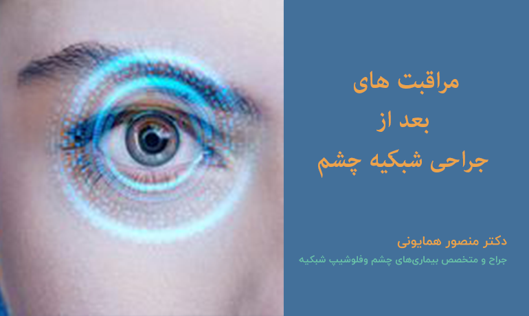 مراقبت بعد از جراحی های شبکیه چشم