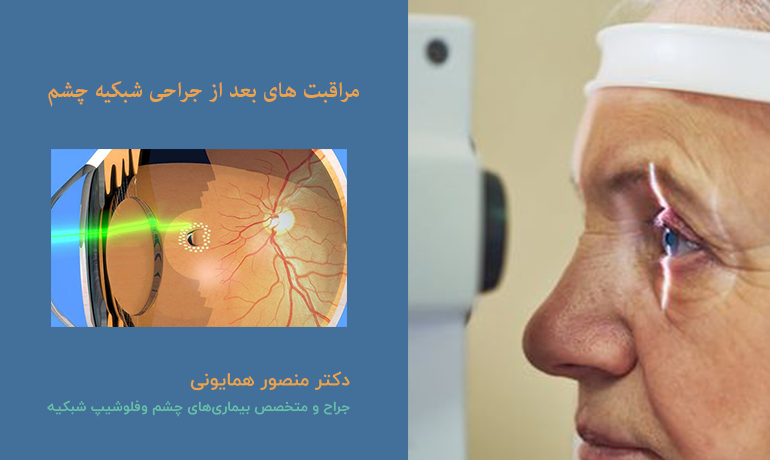 مراقبت های بعد از جراحی شبکیه چشم