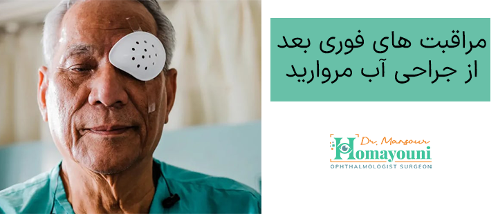 مراقبت های فوری بعد از آب مروارید