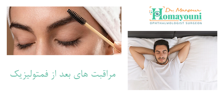 درباره مراقبت های بعد از فمتولیزیک