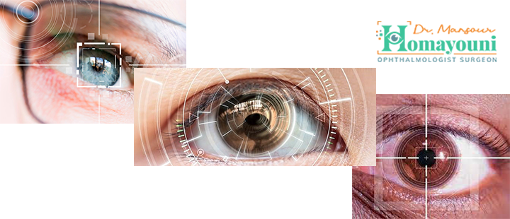 جراحی اسمایل چشم چیست؟
