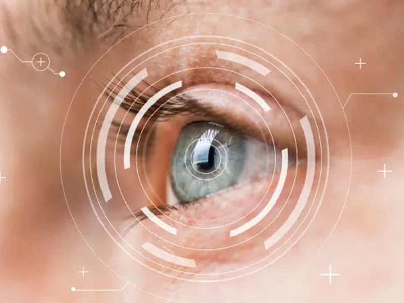 جراحی اسمایل چشم