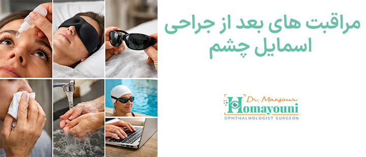 مراقبت های بعد از جراحی اسمایل