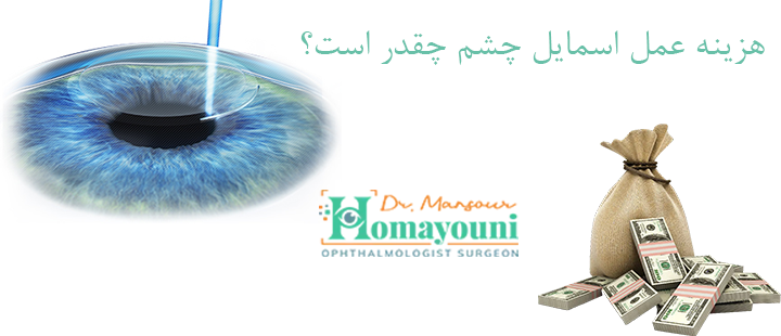 درباره هزینه اسمایل چشم