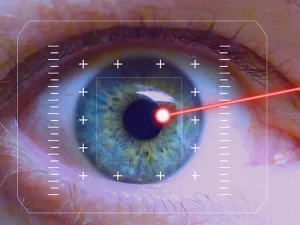 ماندگاری عمل اسمایل چشم