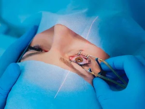 مراقبت های بعد از جراحی اسمایل