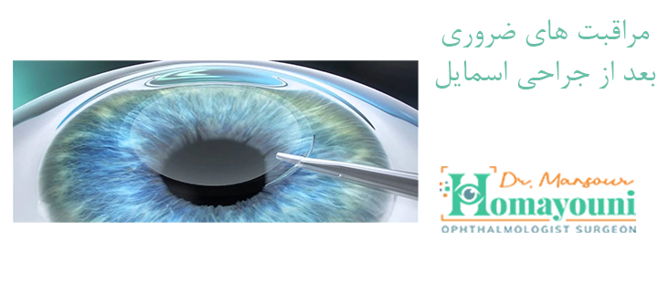 مراقبت های ضروری بعد از جراحی اسمایل