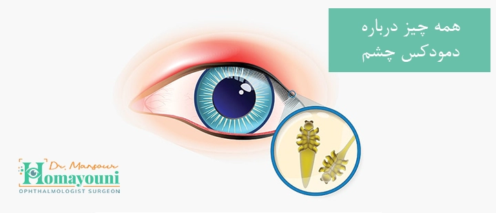 همه چیز درباره دمودکس چشم