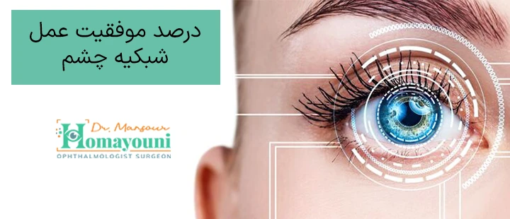 درصد موفقیت عمل شبکیه چشم