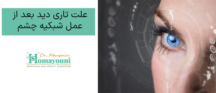 علت تاری دید بعد از عمل شبکیه چشم