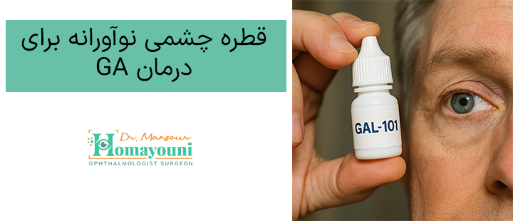 قطره چشمی نوآورانه برای درمان GA