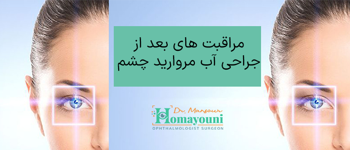 مراقبت های بعد از جراحی آب مروارید چشم