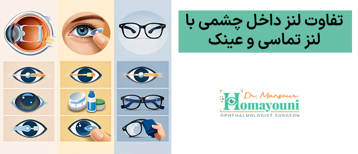 تفاوت لنز داخل چشمی با لنز تماسی و عینک