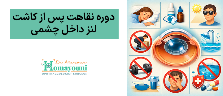 دوره نقاهت پس از کاشت لنز داخل چشمی