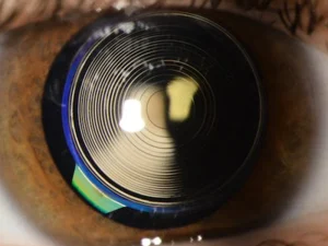 لنز داخل چشمی