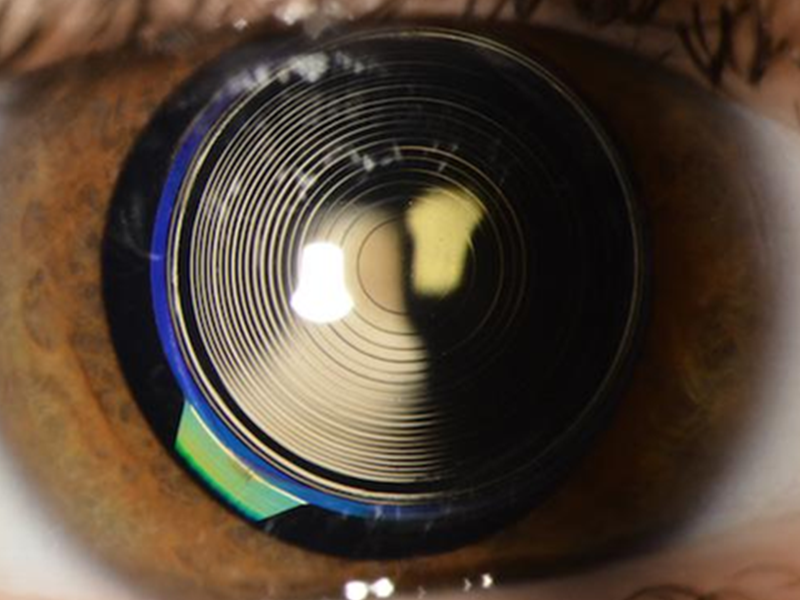 لنز داخل چشمی