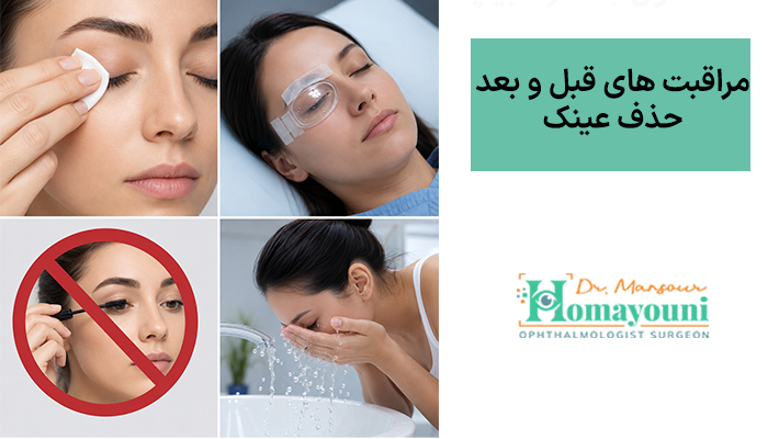 مراقبت های قبل و بعد حذف عینک