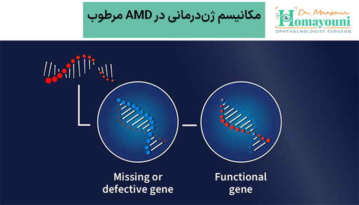 مکانیسم ژن‌درمانی در AMD مرطوب